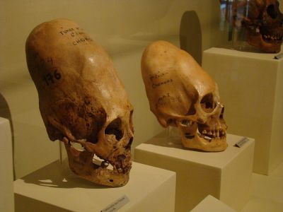 elongated_skull_side-png