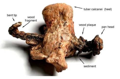 Heel Bone of Crucified Man